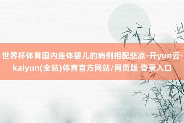 世界杯体育国内连体婴儿的病例相配悲凉-开yun云·kaiyun(全站)体育官方网站/网页版 登录入口